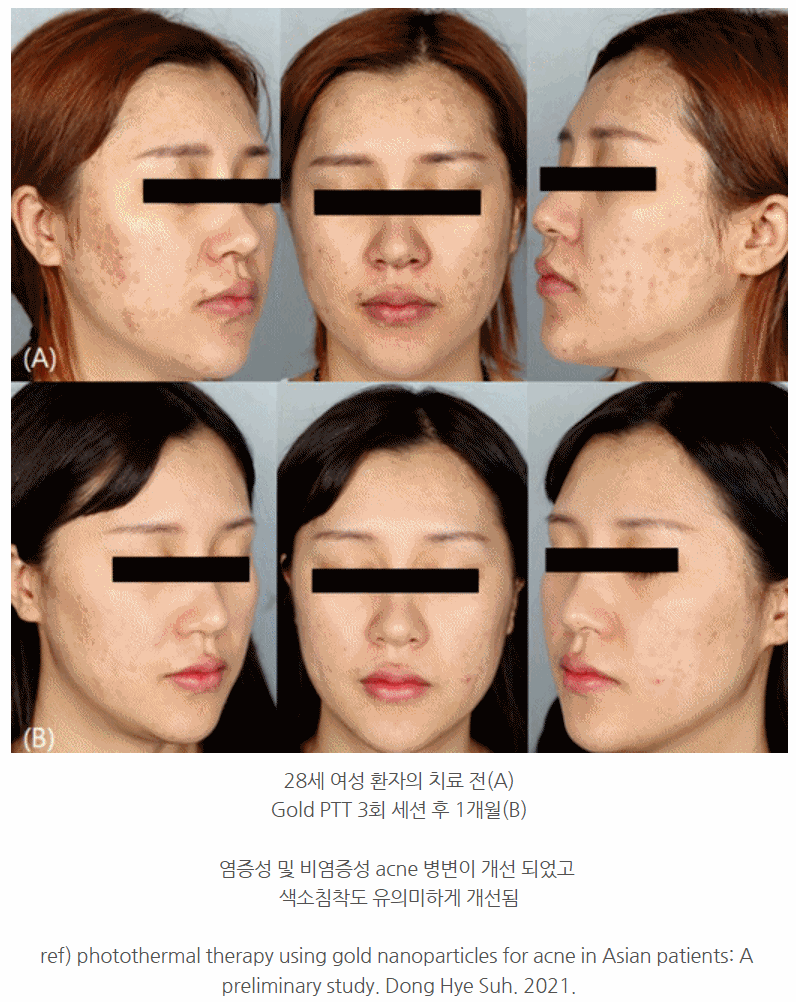 용인 골드ptt 의료진이 직접 말하는 흔히 오해하는 3가지 사진