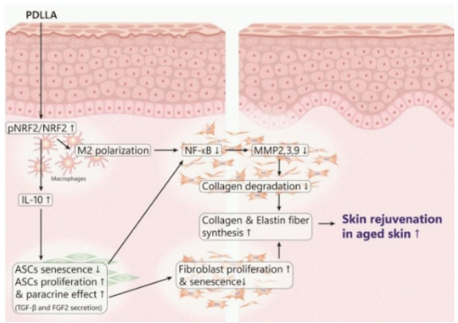 수원쥬베룩볼륨 vs 필러 11년 차 전문의가 딱 정리해 드립니다 사진