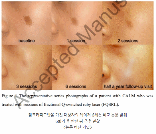용인 밀크커피반점 우리 아이위해 꼭 알아야 하는 3가지(아기-성인 치료) 사진