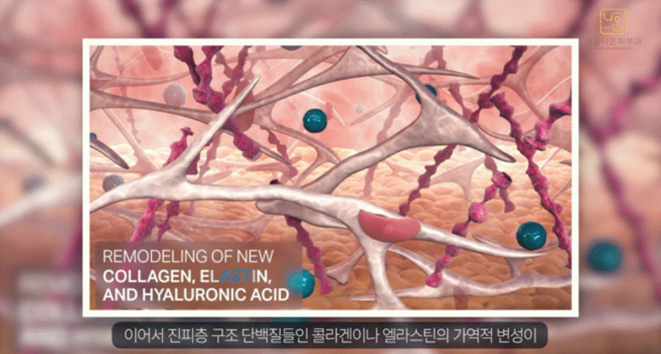 수원 소프웨이브, “이 정도면 아직 안 해도 되는 걸까요?” 사진