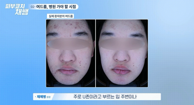 피드 이미지