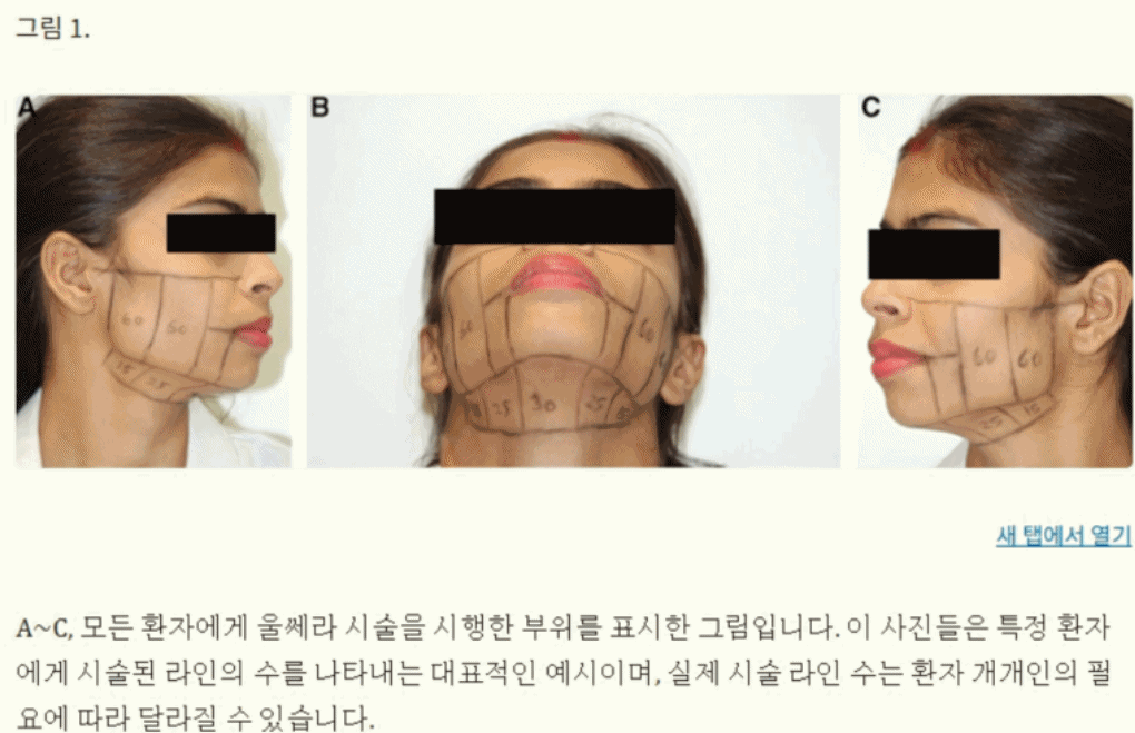 피드 이미지